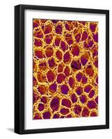 Blood Vessel Cast from Stomach of a Rat-Micro Discovery-Framed Photographic Print