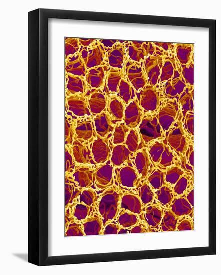 Blood Vessel Cast from Stomach of a Rat-Micro Discovery-Framed Photographic Print