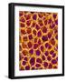 Blood Vessel Cast from Stomach of a Rat-Micro Discovery-Framed Photographic Print