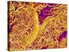 Blood Vessel Cast in Connective Tissue of a Rat-Micro Discovery-Stretched Canvas