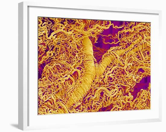 Blood Vessel Cast in Connective Tissue of a Rat-Micro Discovery-Framed Photographic Print