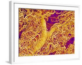 Blood Vessel Cast in Connective Tissue of a Rat-Micro Discovery-Framed Photographic Print