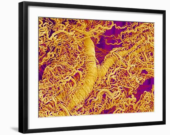 Blood Vessel Cast in Connective Tissue of a Rat-Micro Discovery-Framed Photographic Print