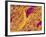 Blood Vessel Cast in Connective Tissue of a Rat-Micro Discovery-Framed Photographic Print