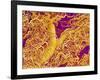 Blood Vessel Cast in Connective Tissue of a Rat-Micro Discovery-Framed Photographic Print