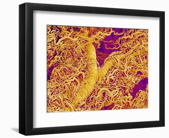 Blood Vessel Cast in Connective Tissue of a Rat-Micro Discovery-Framed Photographic Print