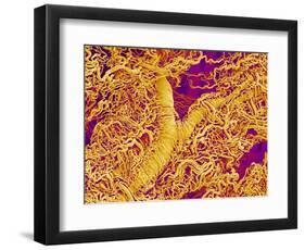 Blood Vessel Cast in Connective Tissue of a Rat-Micro Discovery-Framed Photographic Print