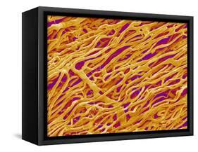 Blood Vessel Cast in Heart of a Rat-Micro Discovery-Framed Stretched Canvas