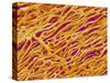 Blood Vessel Cast in Heart of a Rat-Micro Discovery-Stretched Canvas