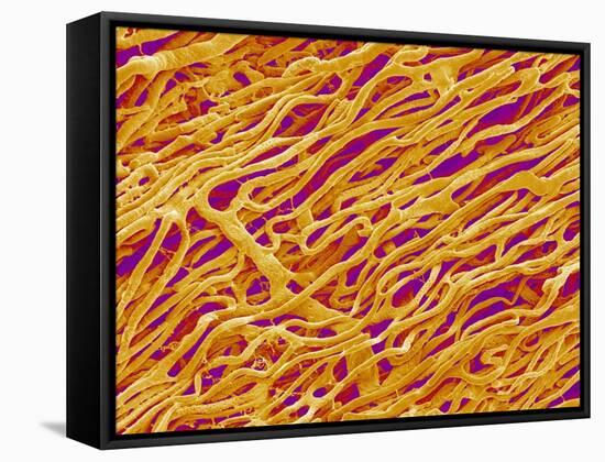 Blood Vessel Cast in Heart of a Rat-Micro Discovery-Framed Stretched Canvas