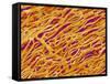 Blood Vessel Cast in Heart of a Rat-Micro Discovery-Framed Stretched Canvas