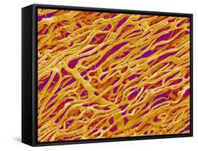 Blood Vessel Cast in Heart of a Rat-Micro Discovery-Framed Stretched Canvas