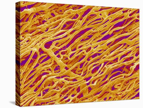 Blood Vessel Cast in Heart of a Rat-Micro Discovery-Stretched Canvas