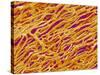 Blood Vessel Cast in Heart of a Rat-Micro Discovery-Stretched Canvas