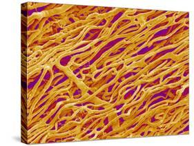 Blood Vessel Cast in Heart of a Rat-Micro Discovery-Stretched Canvas