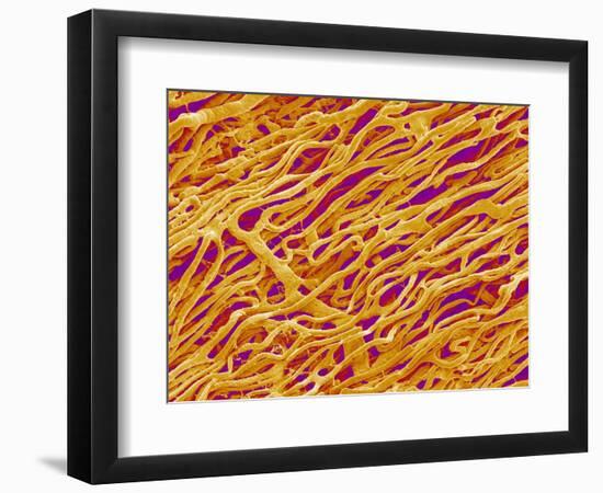 Blood Vessel Cast in Heart of a Rat-Micro Discovery-Framed Photographic Print