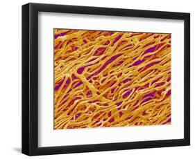 Blood Vessel Cast in Heart of a Rat-Micro Discovery-Framed Photographic Print