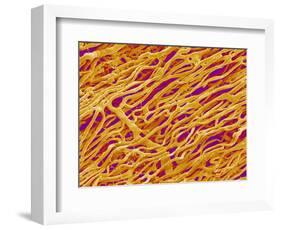 Blood Vessel Cast in Heart of a Rat-Micro Discovery-Framed Photographic Print