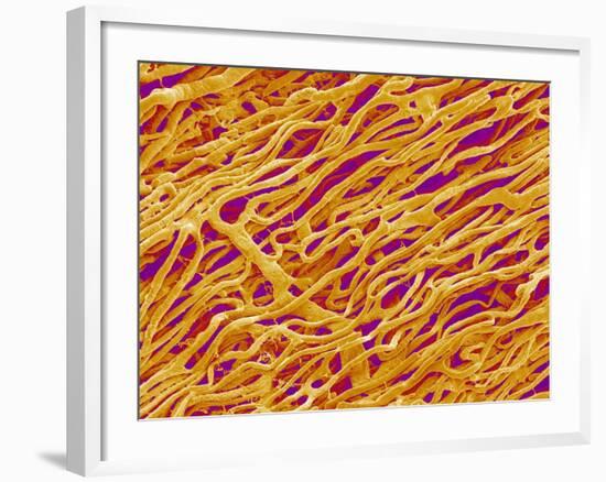 Blood Vessel Cast in Heart of a Rat-Micro Discovery-Framed Photographic Print