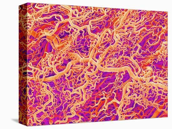 Blood Vessel Cast of Connective Tissue of a Rat-Micro Discovery-Stretched Canvas
