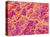 Blood Vessel Cast of Connective Tissue of a Rat-Micro Discovery-Stretched Canvas