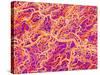 Blood Vessel Cast of Connective Tissue of a Rat-Micro Discovery-Stretched Canvas