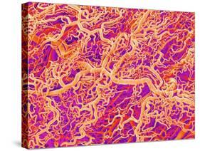 Blood Vessel Cast of Connective Tissue of a Rat-Micro Discovery-Stretched Canvas