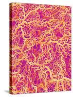 Blood Vessel Cast of Connective Tissue of a Rat-Micro Discovery-Stretched Canvas