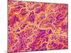 Blood Vessel Cast of Connective Tissue of a Rat-Micro Discovery-Mounted Photographic Print