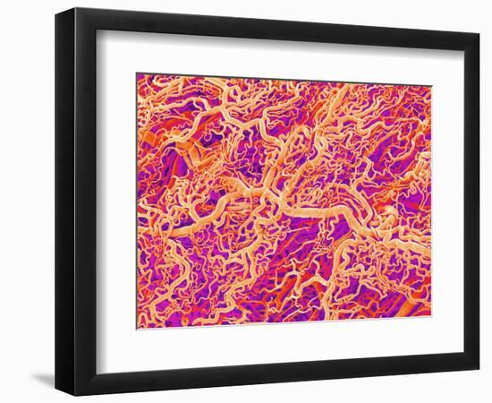 Blood Vessel Cast of Connective Tissue of a Rat-Micro Discovery-Framed Photographic Print