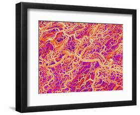 Blood Vessel Cast of Connective Tissue of a Rat-Micro Discovery-Framed Photographic Print