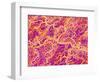 Blood Vessel Cast of Connective Tissue of a Rat-Micro Discovery-Framed Photographic Print