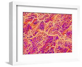 Blood Vessel Cast of Connective Tissue of a Rat-Micro Discovery-Framed Photographic Print