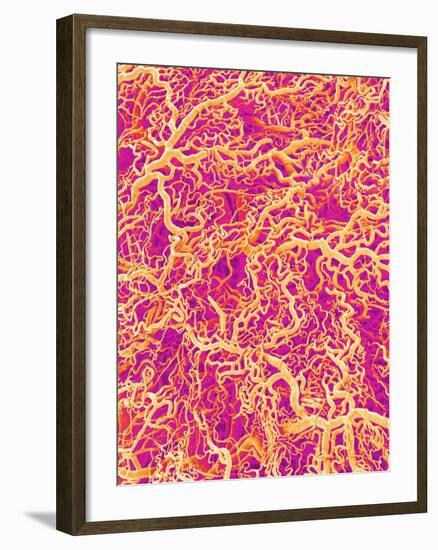 Blood Vessel Cast of Connective Tissue of a Rat-Micro Discovery-Framed Photographic Print