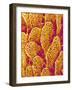 Blood Vessel Cast of the Duodenum of a Rat-Micro Discovery-Framed Photographic Print