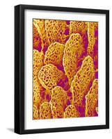 Blood Vessel Cast of the Duodenum of a Rat-Micro Discovery-Framed Photographic Print