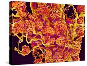 Blood Vessels and Corpus Luteum in Ovary of a Frog-Micro Discovery-Stretched Canvas