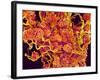 Blood Vessels and Corpus Luteum in Ovary of a Frog-Micro Discovery-Framed Photographic Print