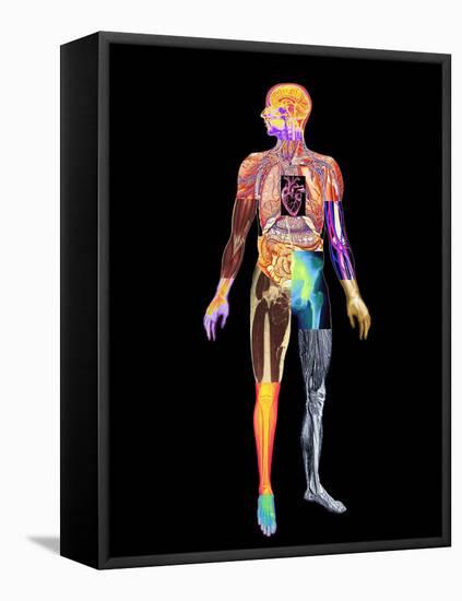 Body Imaging-Mehau Kulyk-Framed Stretched Canvas