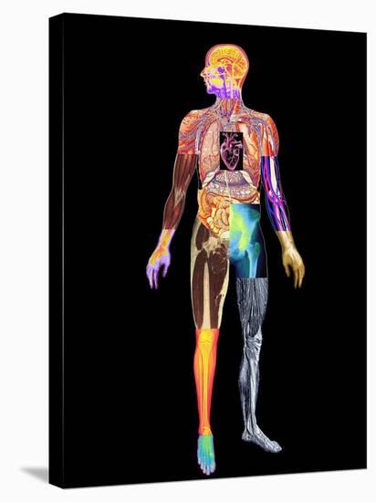 Body Imaging-Mehau Kulyk-Stretched Canvas