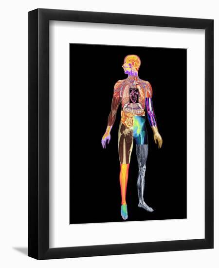 Body Imaging-Mehau Kulyk-Framed Premium Photographic Print