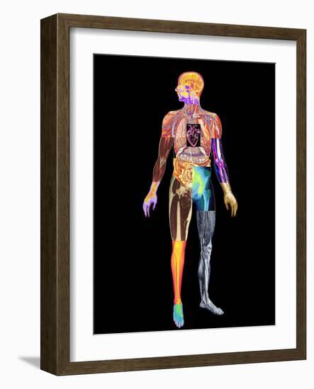 Body Imaging-Mehau Kulyk-Framed Photographic Print