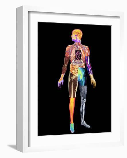 Body Imaging-Mehau Kulyk-Framed Photographic Print