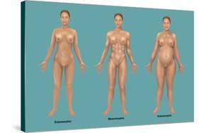 Body Types-Gwen Shockey-Stretched Canvas