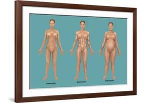 Body Types-Gwen Shockey-Framed Giclee Print