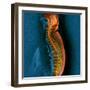 Bone Cancer, MRI-Du Cane Medical-Framed Premium Photographic Print