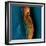 Bone Cancer, MRI-Du Cane Medical-Framed Premium Photographic Print