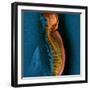 Bone Cancer, MRI-Du Cane Medical-Framed Premium Photographic Print