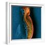 Bone Cancer, MRI-Du Cane Medical-Framed Premium Photographic Print