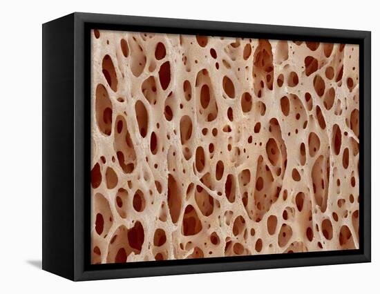 Bone tissue of a hen magnified x25-Micro Discovery-Framed Stretched Canvas